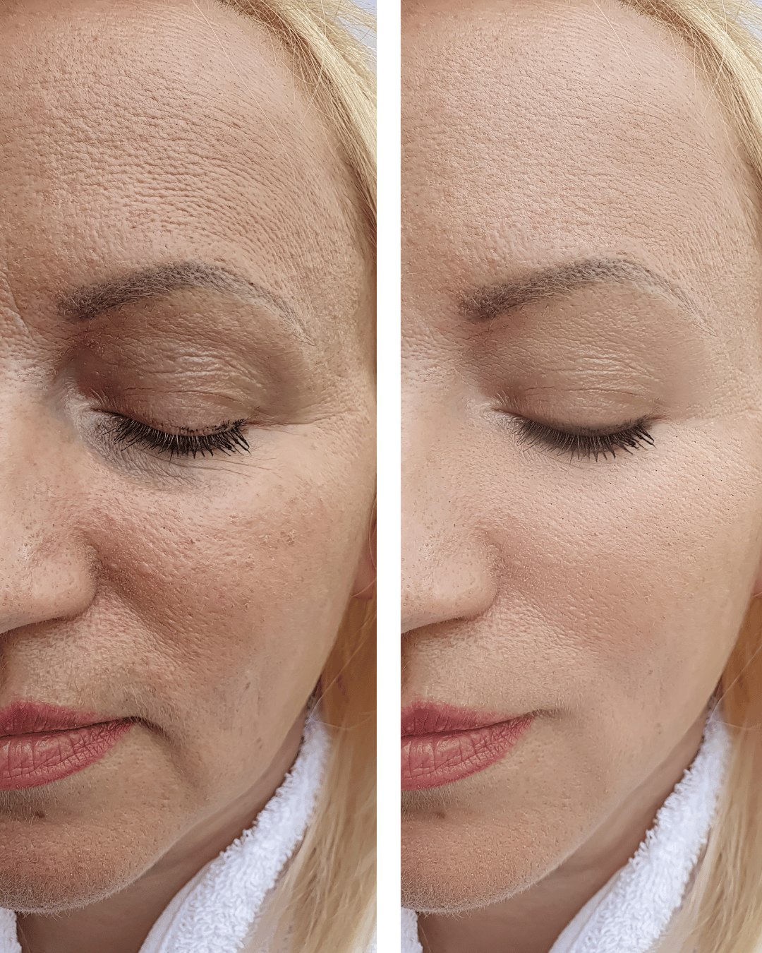 Facial skin improvement before and after