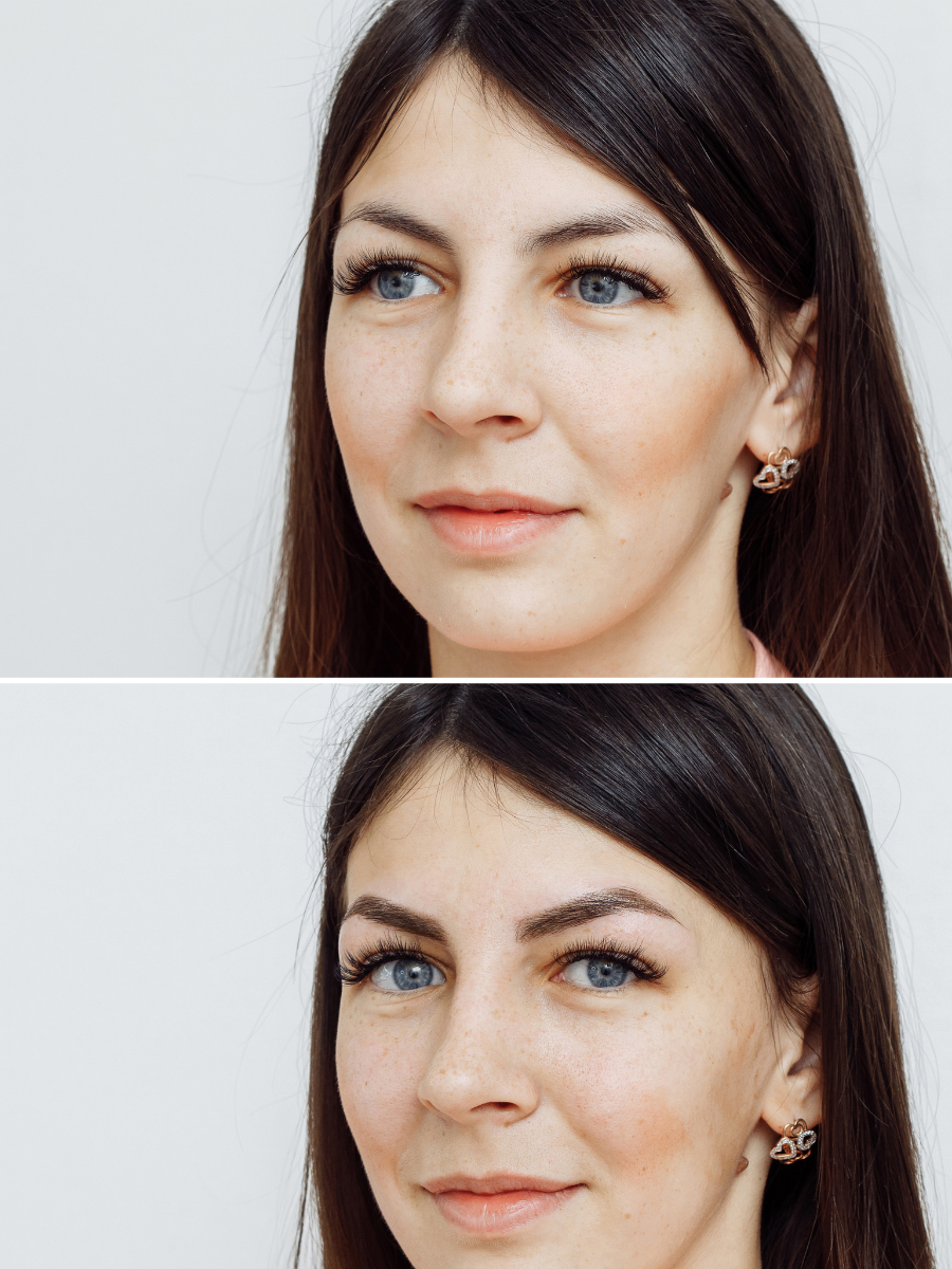 Brow sculpting before and after result