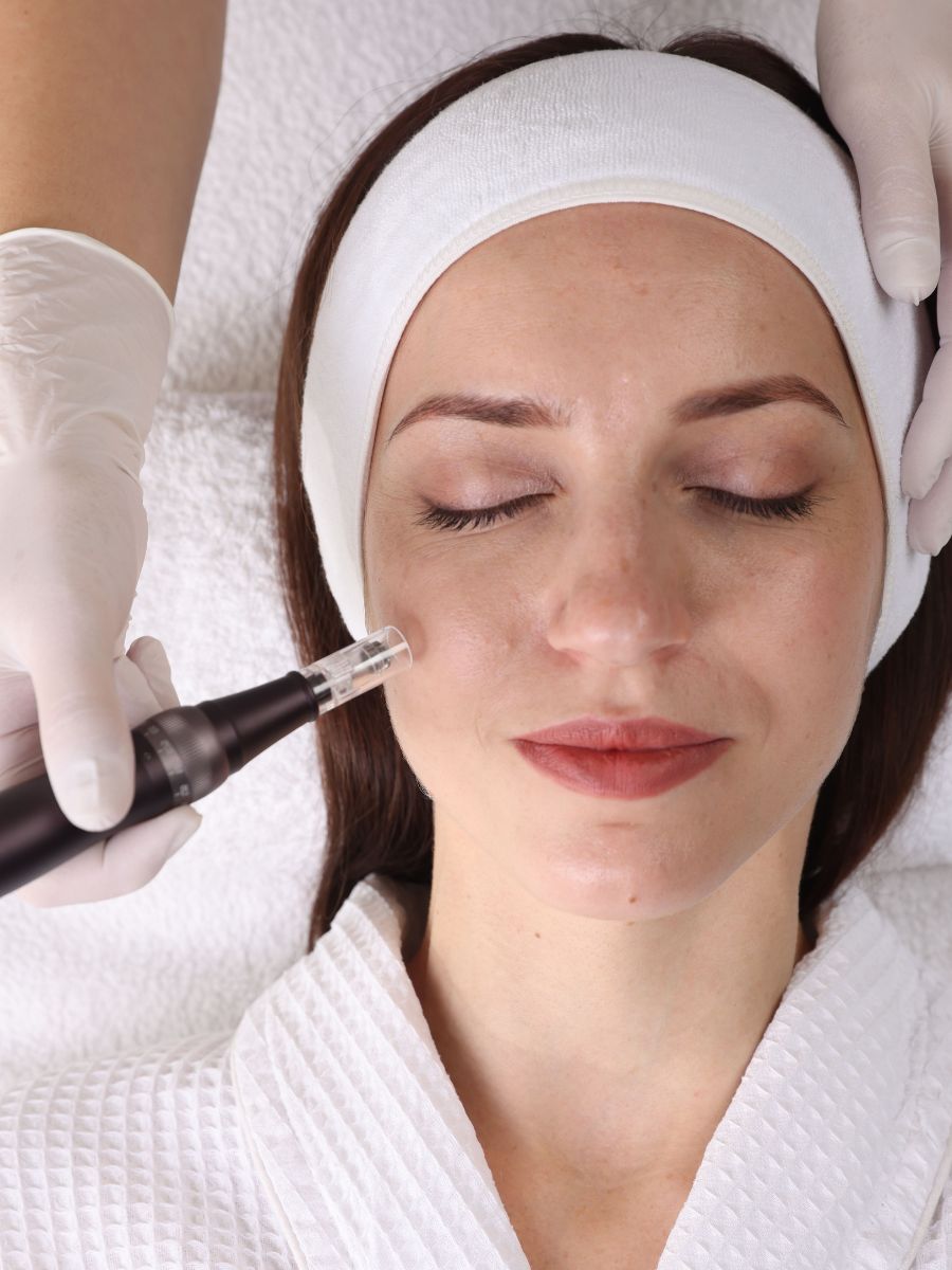 Professional skin needling treatment close up for online microneedling course